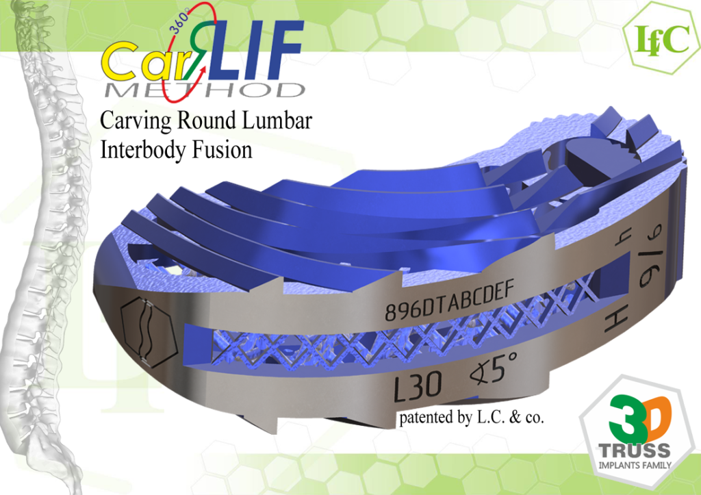 CarRLIF Carving Round Lumbar Interbody Fusion, patented by L.C. & co. 